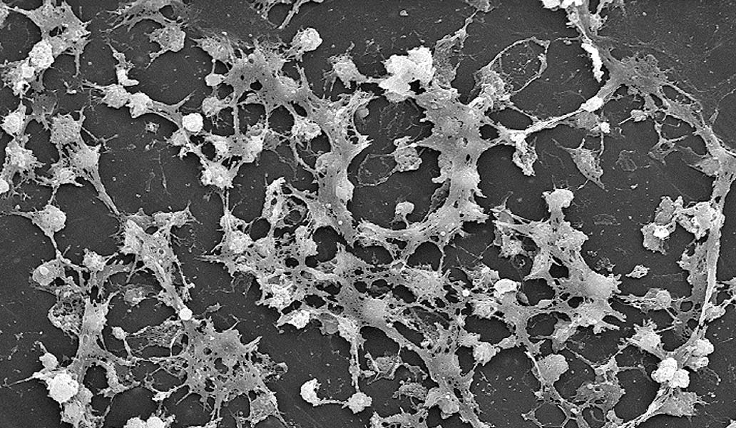 Biofilm, un camino sustentable