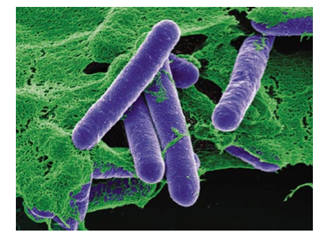 Clostridium botulinum lo que tenes que saber