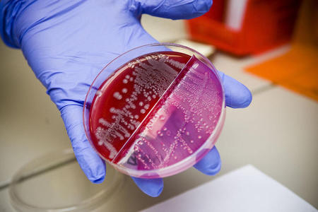 Bacteria: come el CO2 e H2 y excreta combustible